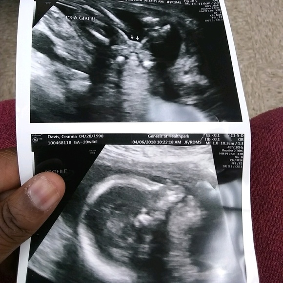 Meet your Posher, Ceanna - Picture 1 of 1